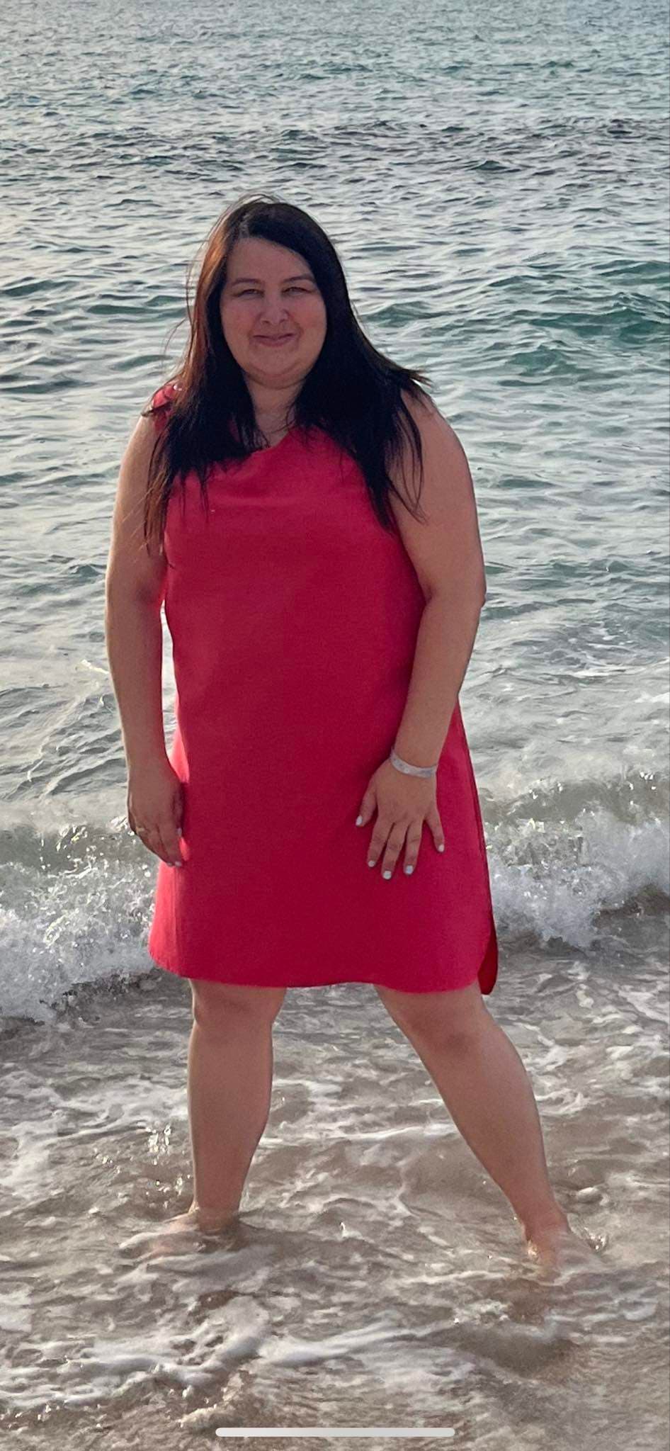 Agnieszka N. - przed