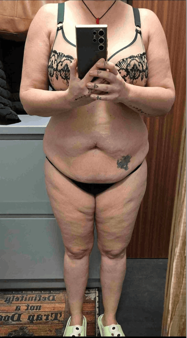 Agnieszka Ł. - przed